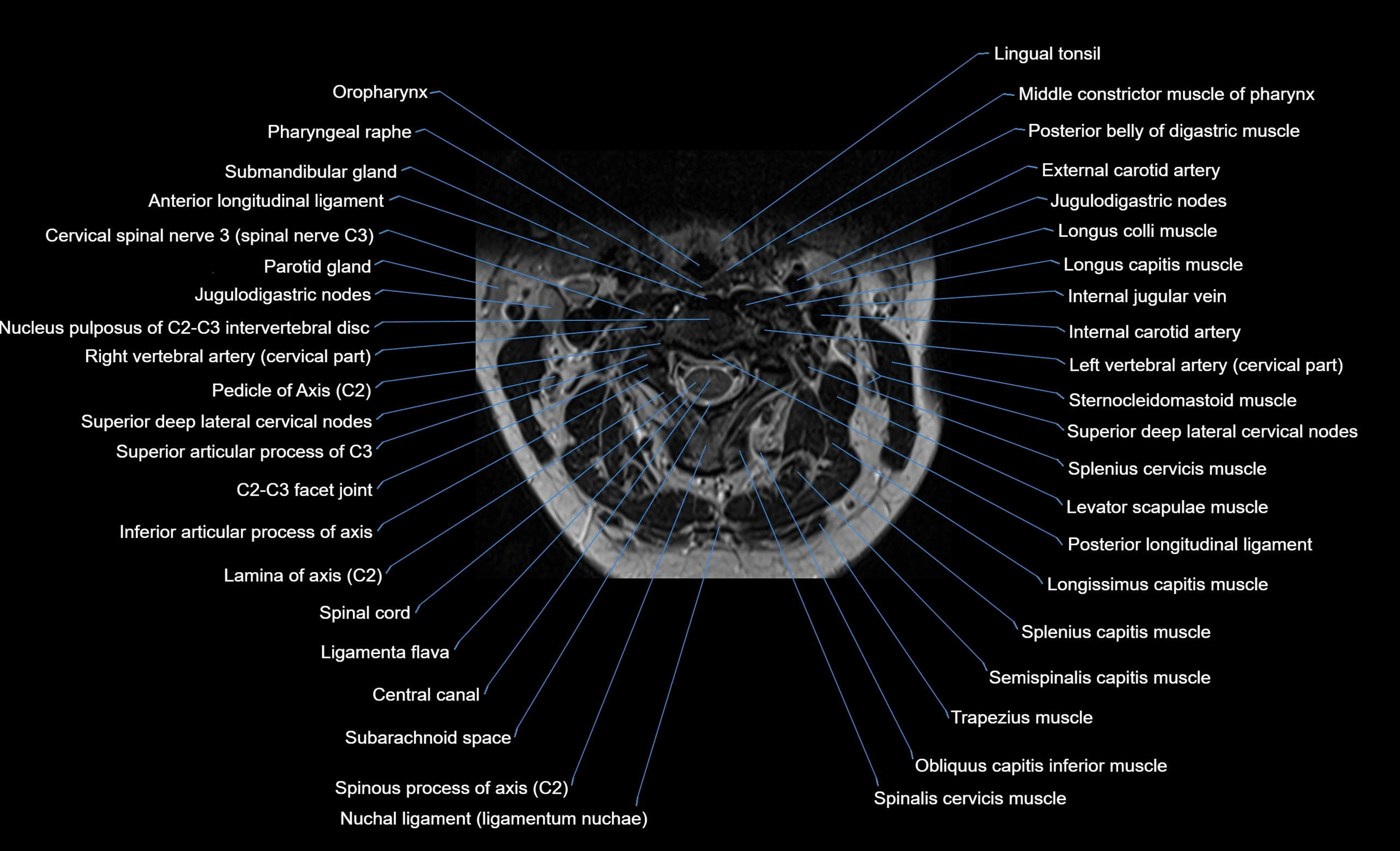 cervical spine cross sectional MRI anatomy  3T MRI axial  image-img-00001-00015.webp